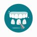 Veneers in Albania by Sidus Dental