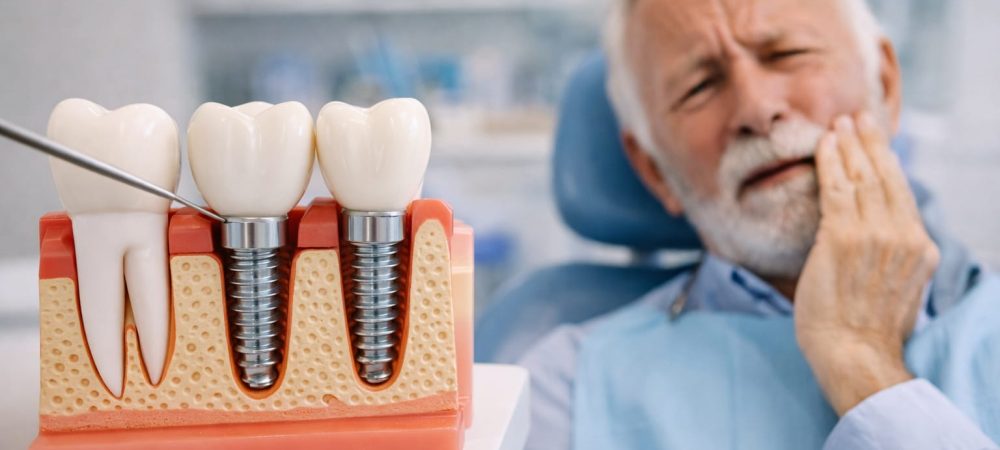 Dental implant in Albania model showing how implants replace missing tooth roots in the jaw